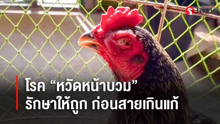 โรค “หวัดหน้าบวม” ไม่ใช่เรื่องเล่น! รู้ให้ลึก รักษาให้ถูก ก่อนสายเกินแก้		
			         		
			         		
			         